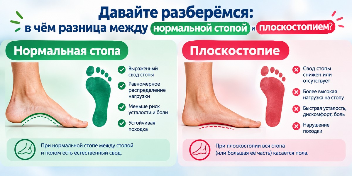 плоскостопие и большая стопа: как выбрать обувь